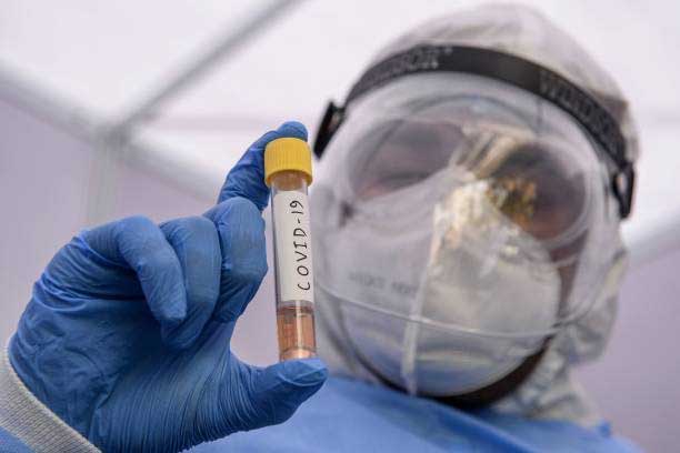 First COVID-19 Death in Chandigarh: 