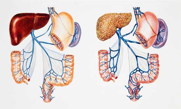 How to Check at Home Fatty Liver?