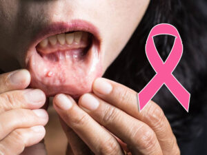 Cancer cases in India भारत में तेजी से बढ़ रहे कैंसर के मरीज: आखिर क्यों चीन और अमेरिका ने कर लिया कंट्रोल, लेकिन भारत पीछे रह गया