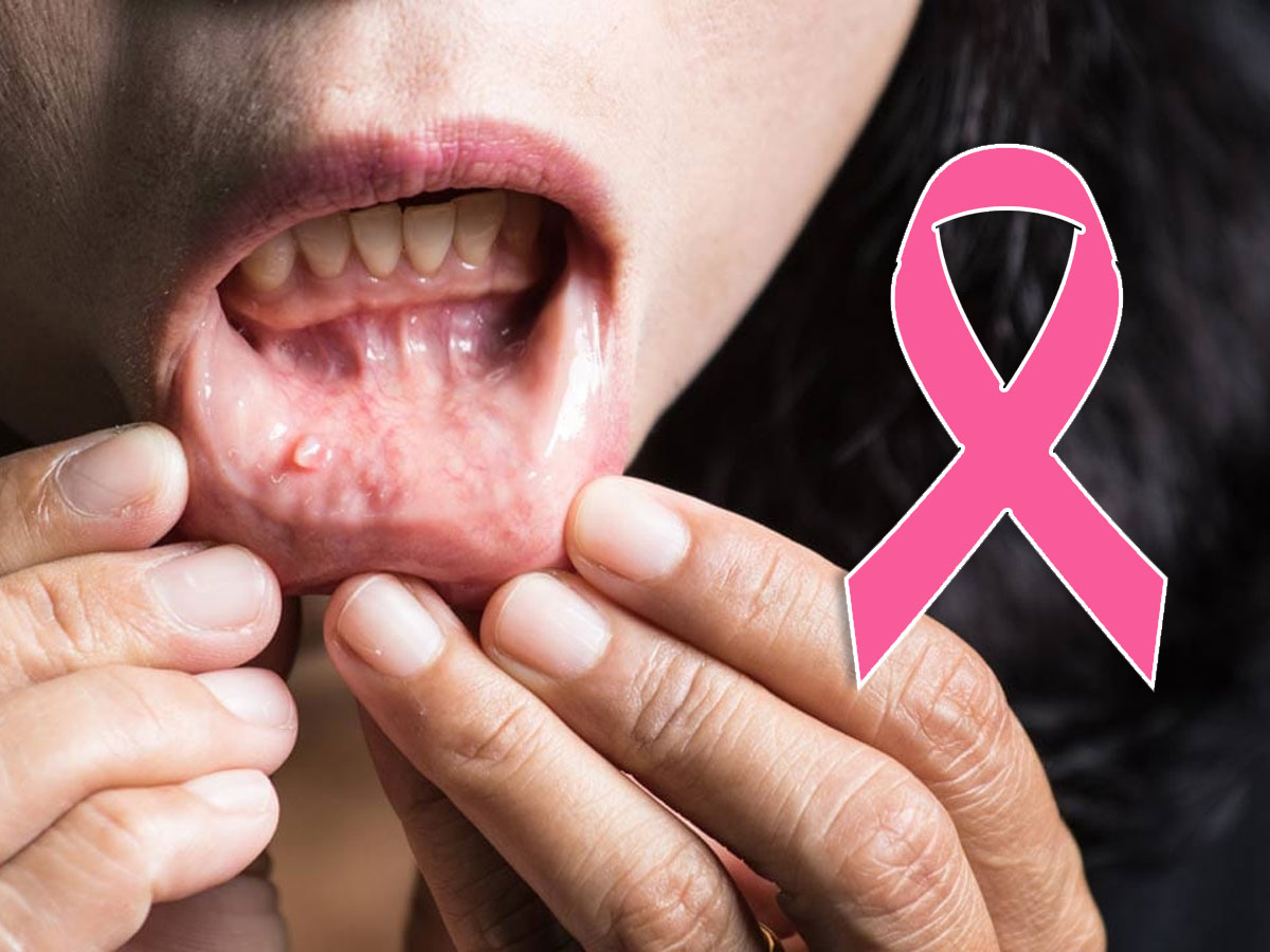 Cancer cases in India भारत में तेजी से बढ़ रहे कैंसर के मरीज: आखिर क्यों चीन और अमेरिका ने कर लिया कंट्रोल, लेकिन भारत पीछे रह गया