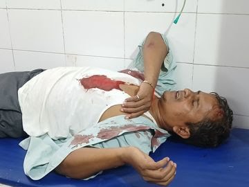 Gorakhpur Land Dispute Yashpal Singh Rawat गोरखपुर में खून सनी जमीन: पूर्व विधायक और पट्टीदारों में भाला फरसा चल गया, तीन घायल  जमीन विवाद ने फिर उगली हिंसा