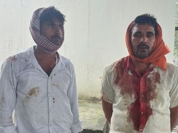 Gorakhpur Land Dispute Yashpal Singh Rawat गोरखपुर में खून सनी जमीन: पूर्व विधायक और पट्टीदारों में भाला फरसा चल गया, तीन घायल  जमीन विवाद ने फिर उगली हिंसा